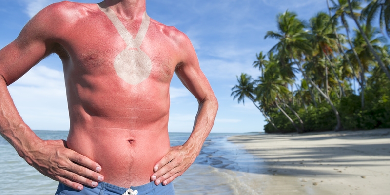 В Ларнаке мужчина получил солнечный алкоудар на пляже