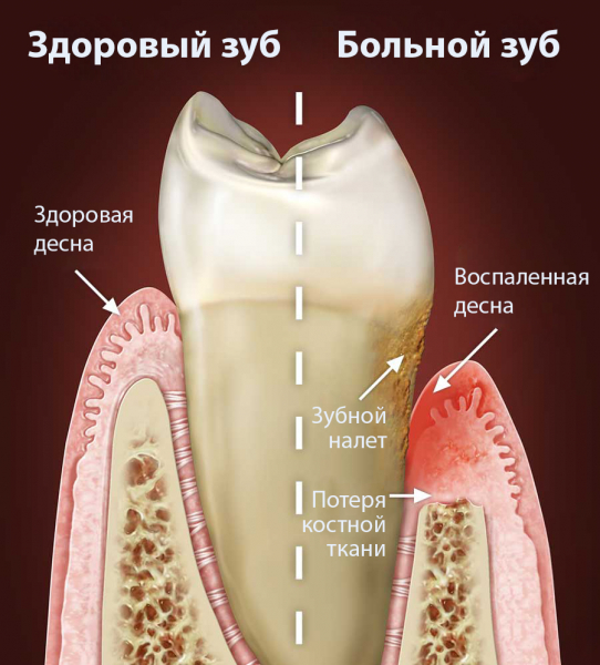
Самые распространенные заболевания полости рта
