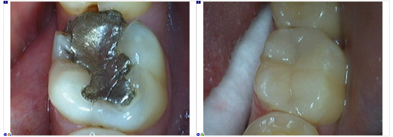 
Эстетическая стоматология — это здоровые и красивые зубы
