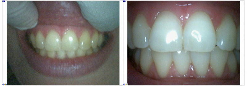
Эстетическая стоматология — это здоровые и красивые зубы
